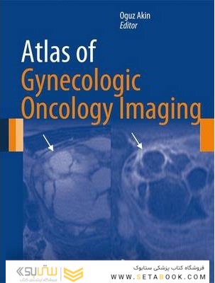 اطلس تصویربرداری انکولوژی زنان