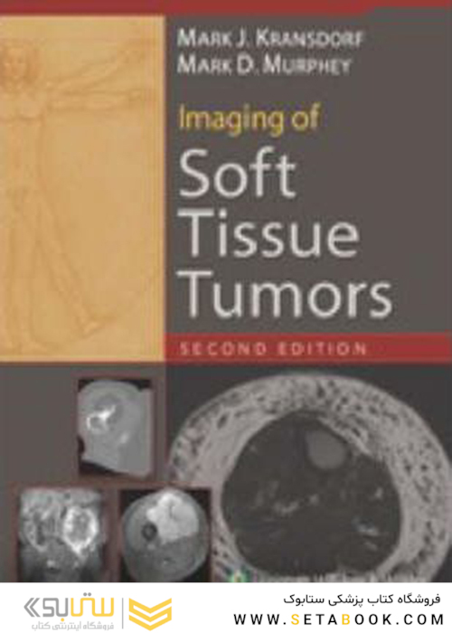 تصویربرداری تومورهای بافت نرم