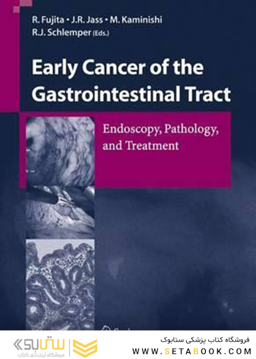 سرطان اولیه دستگاه گوارش