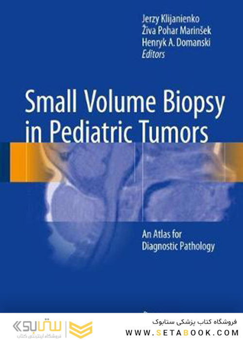 بیوپسی حجم کوچک در تومورهای اطفال