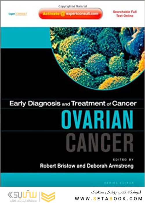 سرطان تخمدان