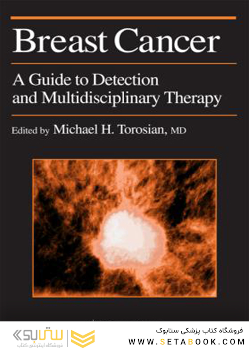 سرطان پستان