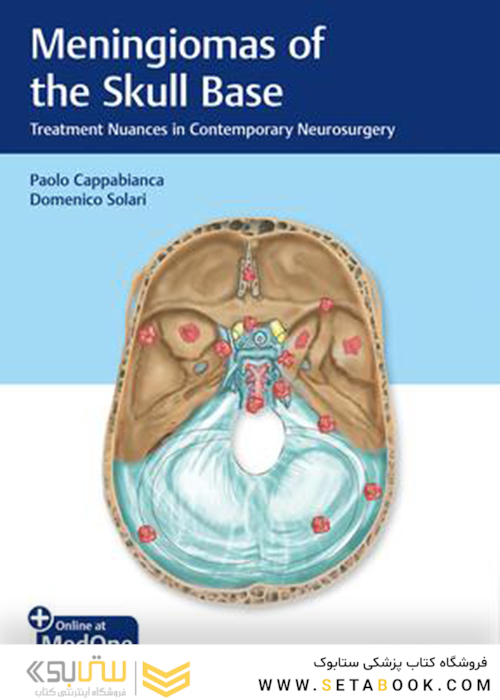 مننژیوم های پایه جمجمه