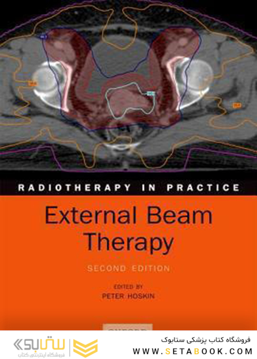 پرتو درمانی خارجی