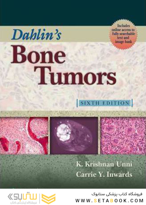 تومورهای استخوانی دالین