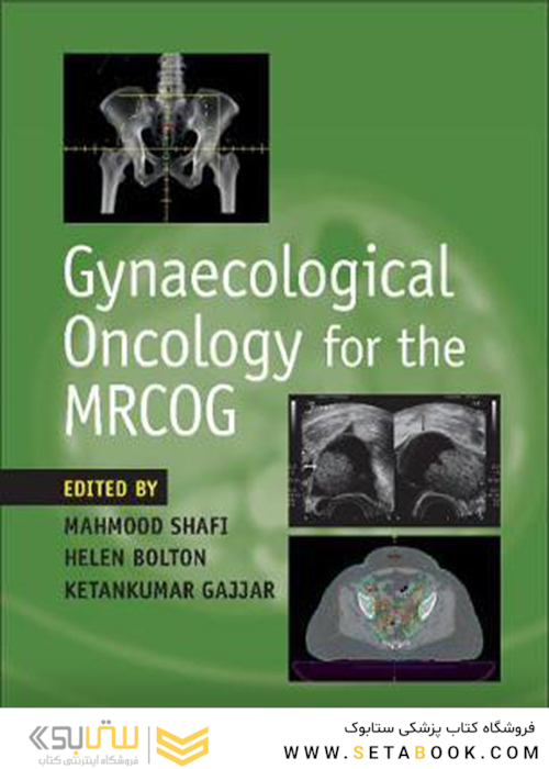 انکولوژی زنان برای MRCOG