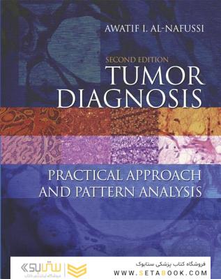 تشخیص تومور 2ED