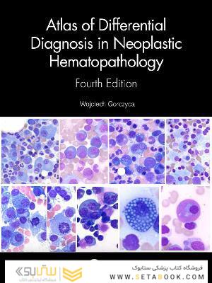 Atlas of Differential Diagnosis in Neoplastic Hematopathology2021