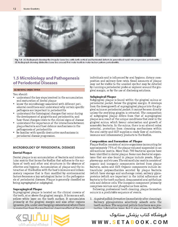 Master Dentistry Volume 2 : Restorative Dentistry, Paediatric Dentistry and Orthodontics2021