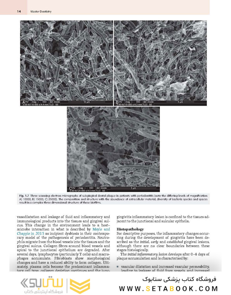 Master Dentistry Volume 2 : Restorative Dentistry, Paediatric Dentistry and Orthodontics2021