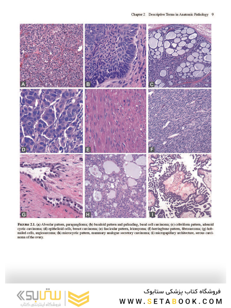The Practice of Surgical Pathology: A Beginner