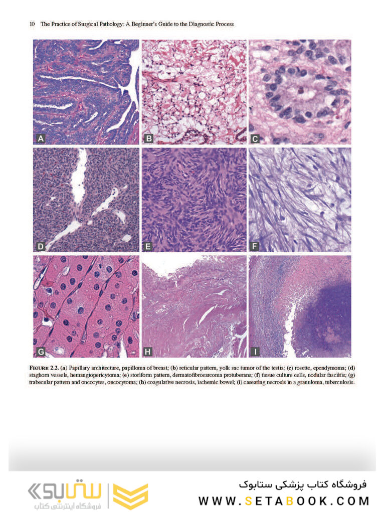 The Practice of Surgical Pathology: A Beginner