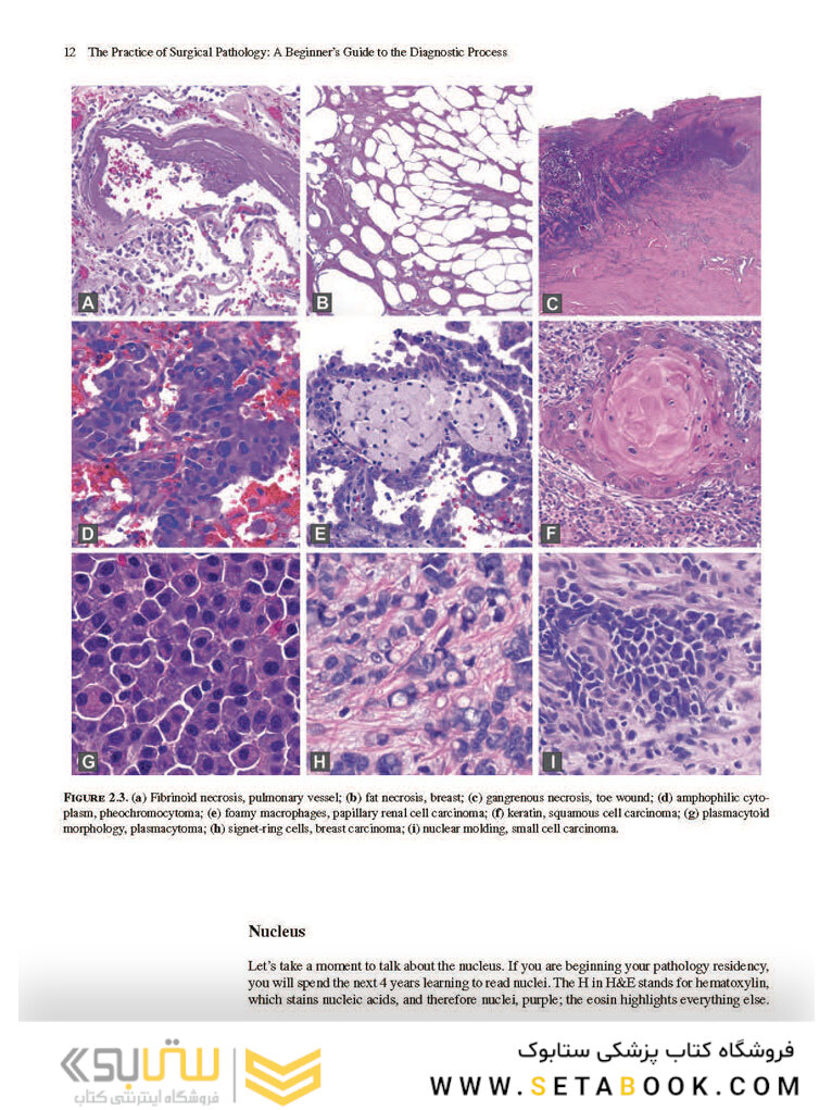 The Practice of Surgical Pathology: A Beginner
