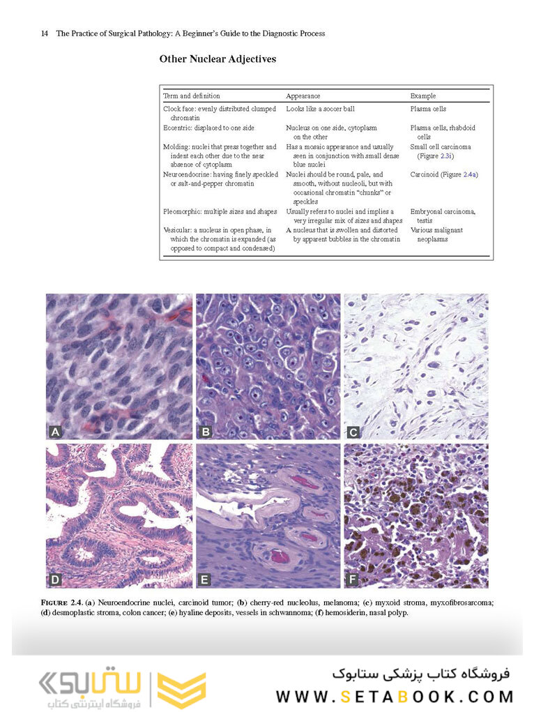 The Practice of Surgical Pathology: A Beginner