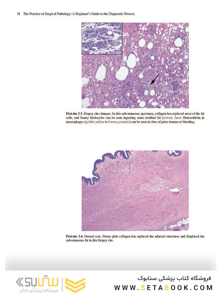 The Practice of Surgical Pathology: A Beginner