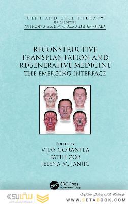 Reconstructive Transplantation and Regenerative Medicine : The Emerging Interface