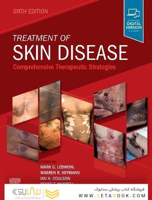 Treatment of Skin Disease : Comprehensive Therapeutic Strategies
