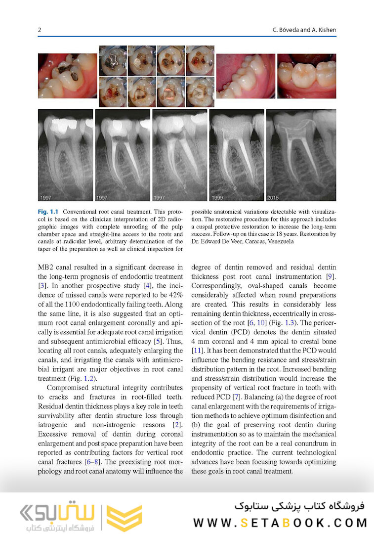 Minimally Invasive Approaches in Endodontic Practice2021