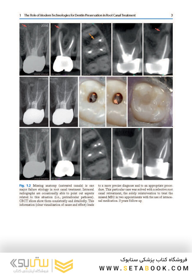 Minimally Invasive Approaches in Endodontic Practice2021