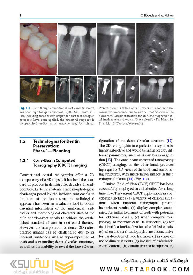 Minimally Invasive Approaches in Endodontic Practice2021