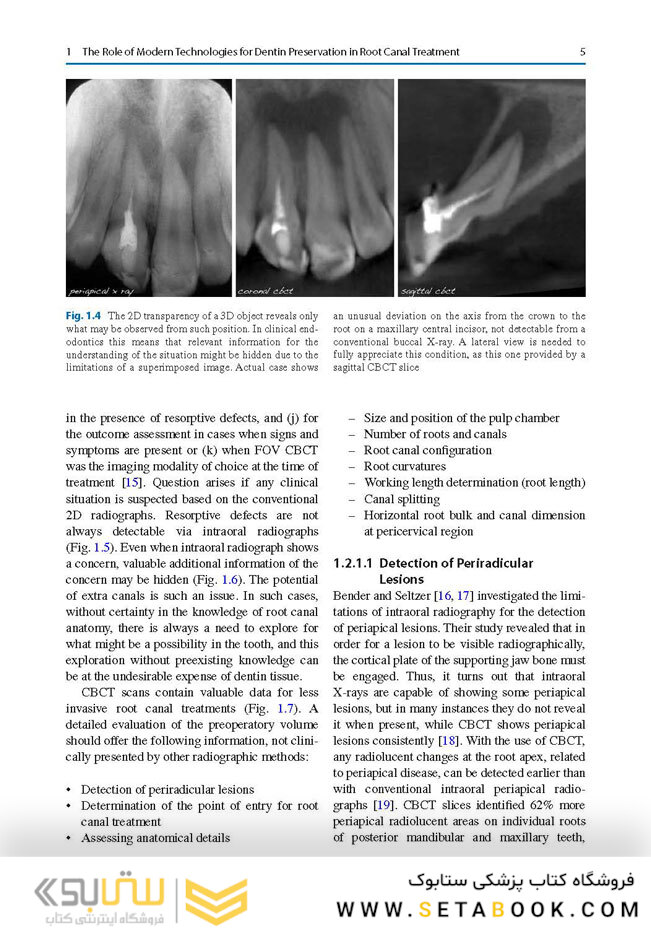 Minimally Invasive Approaches in Endodontic Practice2021