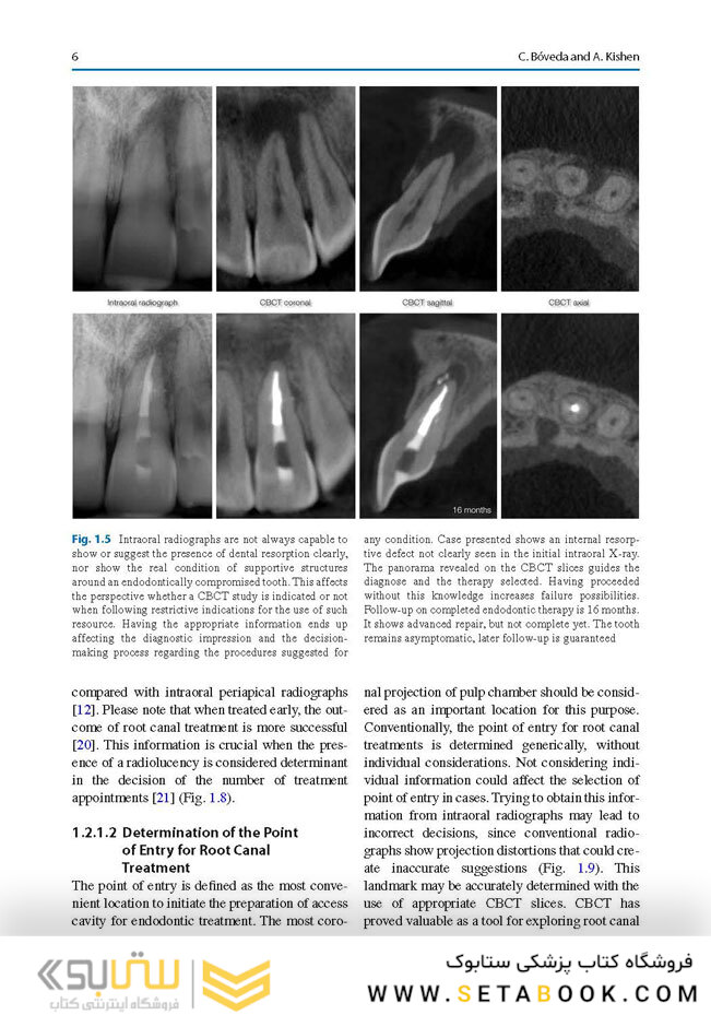 Minimally Invasive Approaches in Endodontic Practice2021