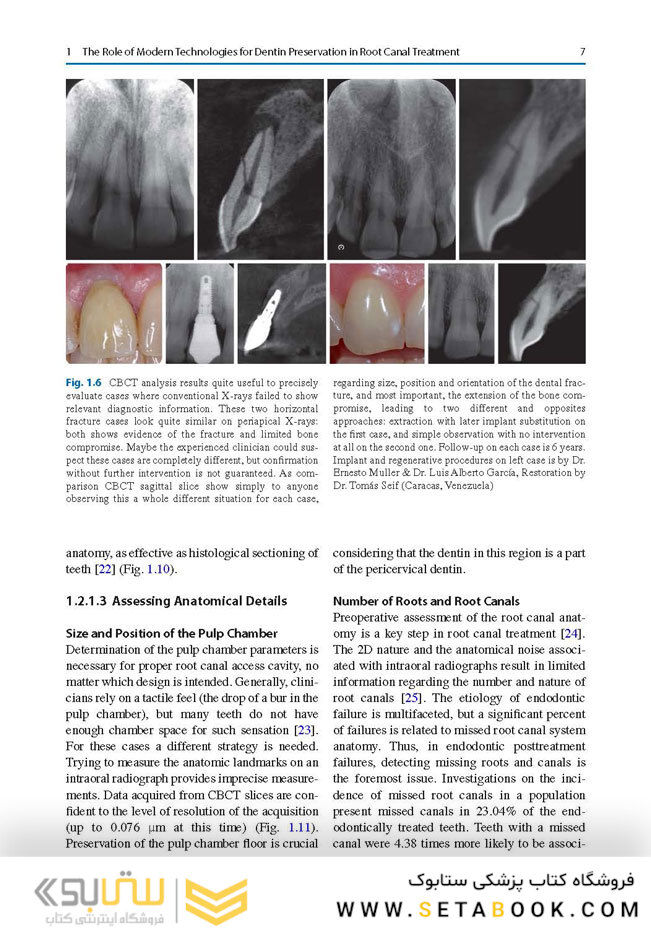Minimally Invasive Approaches in Endodontic Practice2021