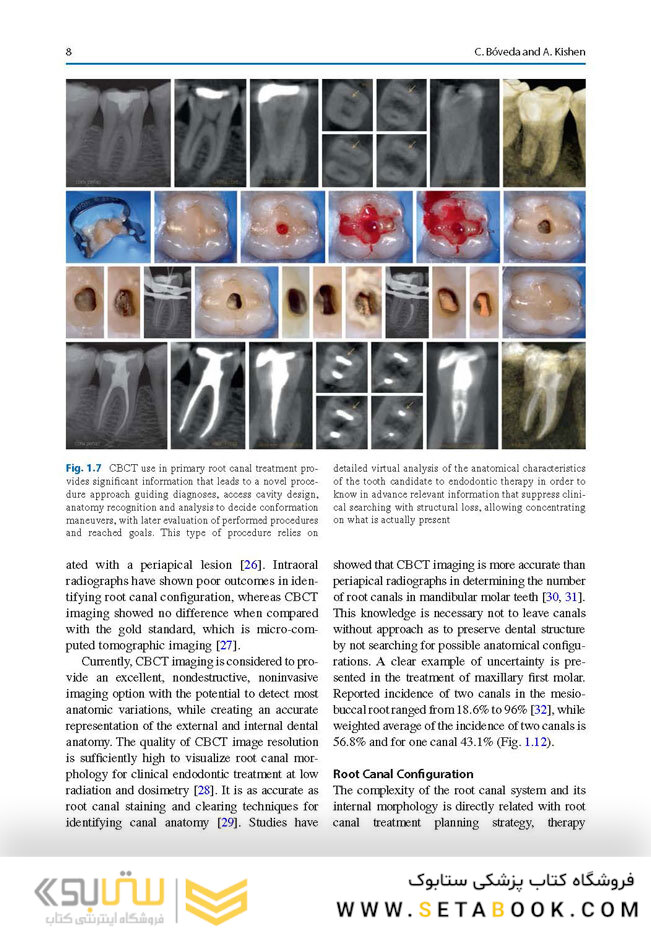 Minimally Invasive Approaches in Endodontic Practice2021