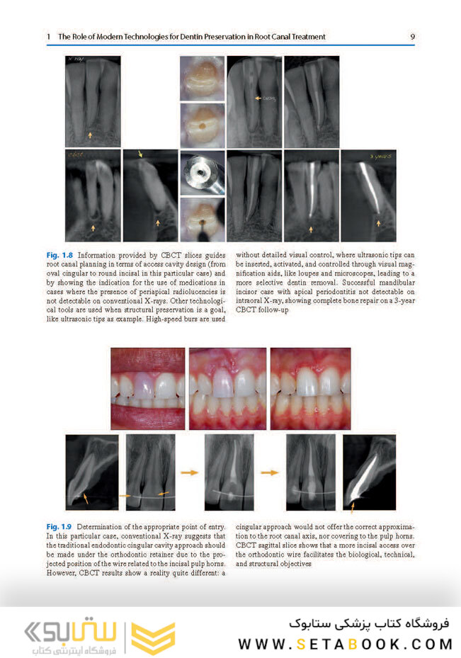 Minimally Invasive Approaches in Endodontic Practice2021