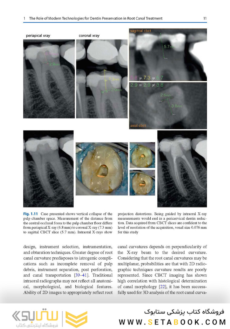 Minimally Invasive Approaches in Endodontic Practice2021