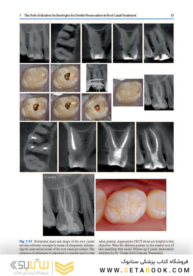 Minimally Invasive Approaches in Endodontic Practice2021