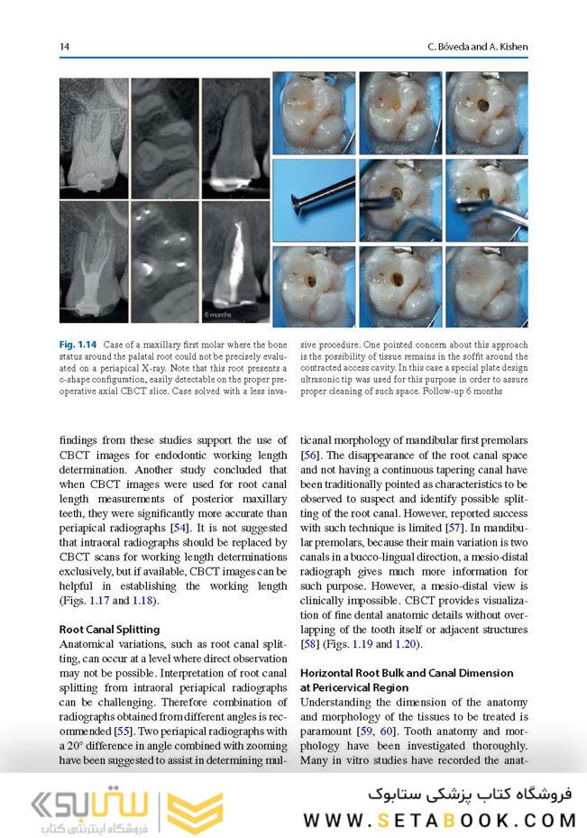 Minimally Invasive Approaches in Endodontic Practice2021