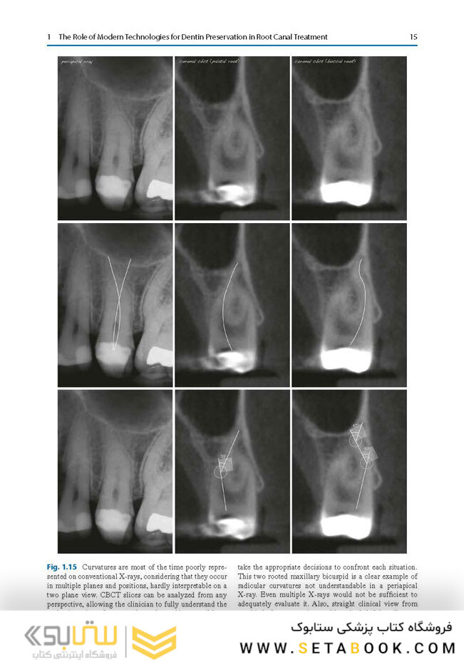 Minimally Invasive Approaches in Endodontic Practice2021