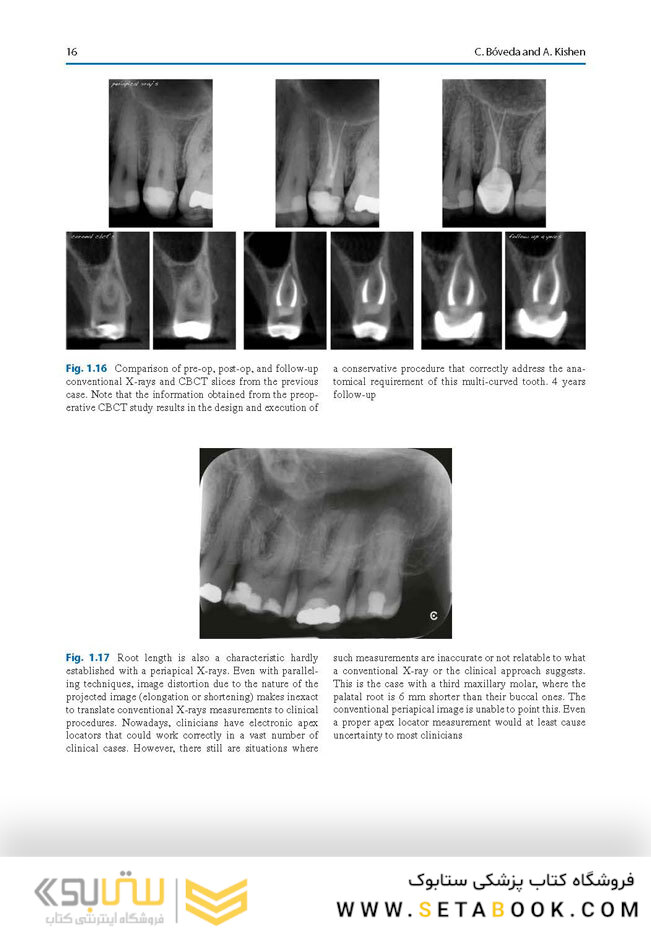 Minimally Invasive Approaches in Endodontic Practice2021