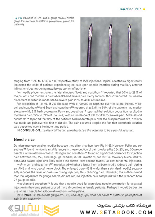 Successful Local Anesthesia for Restorative Dentistry and Endodontics