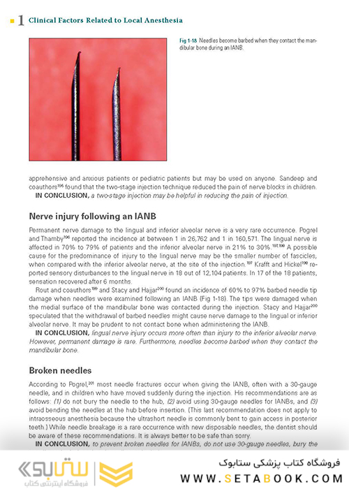 Successful Local Anesthesia for Restorative Dentistry and Endodontics