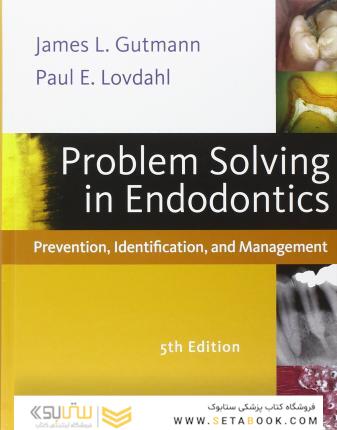Problem Solving in Endodontics : Prevention, Identification and Management