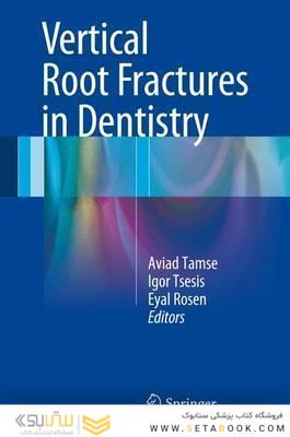 Vertical Root Fractures in Dentistry