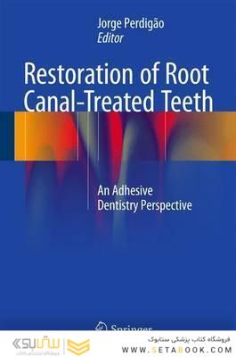 Restoration of Root Canal-Treated Teeth : An Adhesive Dentistry Perspective
