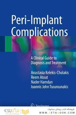 Peri-Implant Complications : A Clinical Guide to Diagnosis and Treatment