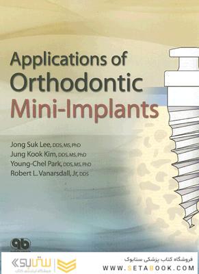 Applications of Orthodontic Mini Implants