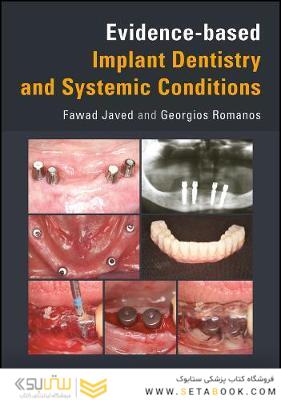 Evidence-based Implant Dentistry and Systemic Conditions