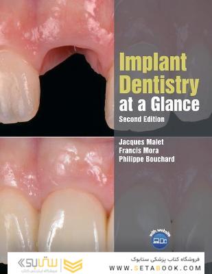 Implant Dentistry at a Glance