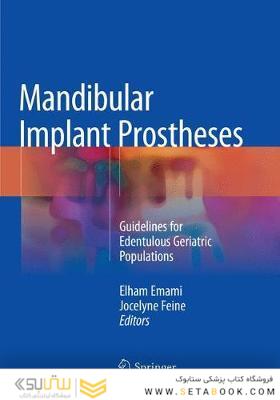 Mandibular Implant Prostheses : Guidelines for Edentulous Geriatric Populations