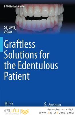 Graftless Solutions for the Edentulous Patient