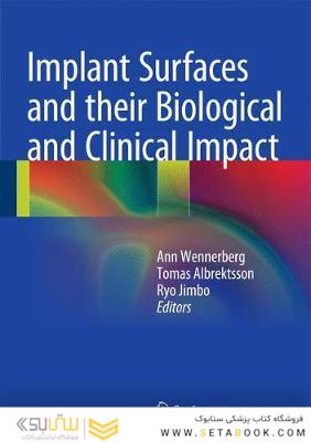 Implant Surfaces and their Biological and Clinical Impact