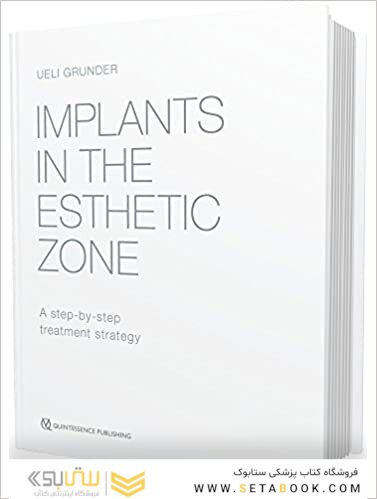 Implants in the Esthetic Zone : A Step-by-Step Treatment Strategy