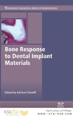 Bone Response to Dental Implant Materials