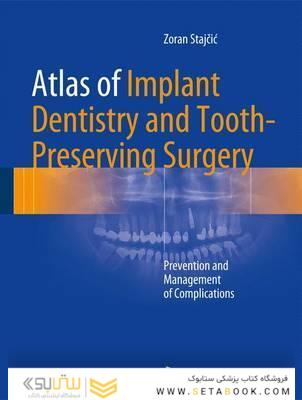 Atlas of Implant Dentistry and Tooth-Preserving Surgery : Prevention and Management of Complications