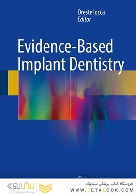 Evidence-Based Implant Dentistry